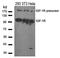 Insulin Like Growth Factor 1 antibody, orb14679, Biorbyt, Western Blot image 