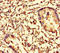 CFL1 antibody, LS-C677515, Lifespan Biosciences, Immunohistochemistry paraffin image 