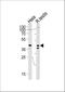 KH RNA Binding Domain Containing, Signal Transduction Associated 2 antibody, A09665-1, Boster Biological Technology, Western Blot image 