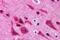 TGF-Beta Activated Kinase 1 (MAP3K7) Binding Protein 2 antibody, MBS150644, MyBioSource, Immunohistochemistry paraffin image 