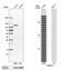Oxysterol Binding Protein Like 3 antibody, NBP1-82968, Novus Biologicals, Western Blot image 