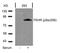 Forkhead Box O1 antibody, P00073, Boster Biological Technology, Western Blot image 