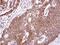 Endothelin Receptor Type B antibody, NBP2-16335, Novus Biologicals, Immunohistochemistry paraffin image 