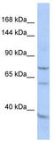 EF-Hand Domain Family Member B antibody, TA340363, Origene, Western Blot image 