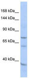 EF-Hand Domain Family Member B antibody, TA340363, Origene, Western Blot image 