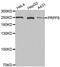 Pre-MRNA Processing Factor 8 antibody, PA5-76193, Invitrogen Antibodies, Western Blot image 