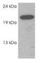 RAB3C, Member RAS Oncogene Family antibody, GTX23336, GeneTex, Western Blot image 