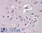 Rho GDP Dissociation Inhibitor Gamma antibody, LS-B8339, Lifespan Biosciences, Immunohistochemistry frozen image 