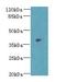 Delta Like Non-Canonical Notch Ligand 2 antibody, A66110-100, Epigentek, Western Blot image 