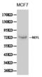 Neurofilament Light antibody, LS-C192234, Lifespan Biosciences, Western Blot image 