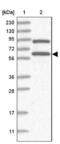 Ring Finger Protein 25 antibody, NBP2-32664, Novus Biologicals, Western Blot image 