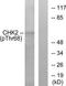 Checkpoint Kinase 2 antibody, TA312769, Origene, Western Blot image 