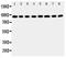 Coagulation Factor VIII antibody, PA5-79228, Invitrogen Antibodies, Western Blot image 