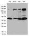 Inhibitor Of Nuclear Factor Kappa B Kinase Regulatory Subunit Gamma antibody, M00874-1, Boster Biological Technology, Western Blot image 