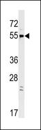 G Protein-Coupled Receptor 22 antibody, LS-C159769, Lifespan Biosciences, Western Blot image 