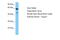 Estrogen Related Receptor Gamma antibody, ARP31655_T100, Aviva Systems Biology, Western Blot image 