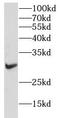 IL2RA antibody, FNab09878, FineTest, Western Blot image 