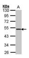 C-X-C Motif Chemokine Receptor 5 antibody, PA5-27170, Invitrogen Antibodies, Western Blot image 