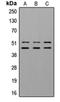 Glycogen Synthase Kinase 3 Alpha antibody, orb216120, Biorbyt, Western Blot image 