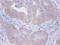 Protein Kinase C Substrate 80K-H antibody, LS-C211731, Lifespan Biosciences, Immunohistochemistry paraffin image 
