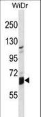 Galactosidase Beta 1 Like antibody, LS-C159734, Lifespan Biosciences, Western Blot image 