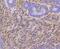TNF Receptor Superfamily Member 12A antibody, NBP2-67729, Novus Biologicals, Immunohistochemistry paraffin image 