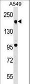 Tet Methylcytosine Dioxygenase 2 antibody, LS-C157167, Lifespan Biosciences, Western Blot image 