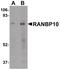 KIAA1464 antibody, PA5-20930, Invitrogen Antibodies, Western Blot image 