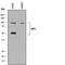 GIT ArfGAP 1 antibody, AF8508, R&D Systems, Western Blot image 