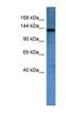 AF4/FMR2 Family Member 1 antibody, NBP1-69027, Novus Biologicals, Western Blot image 