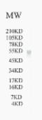 ATP Binding Cassette Subfamily G Member 1 antibody, XG-6129, ProSci, Western Blot image 