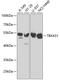 Thromboxane A Synthase 1 antibody, GTX16403, GeneTex, Western Blot image 