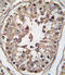 TANK Binding Kinase 1 antibody, abx033745, Abbexa, Immunohistochemistry paraffin image 