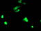 TAL BHLH Transcription Factor 1, Erythroid Differentiation Factor antibody, LS-C173502, Lifespan Biosciences, Immunofluorescence image 