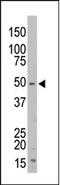 Serine/Threonine Kinase 35 antibody, AP13935PU-N, Origene, Western Blot image 