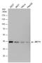 Solute Carrier Family 16 Member 1 antibody, MA5-18288, Invitrogen Antibodies, Western Blot image 