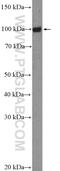 FCRH5 antibody, 26503-1-AP, Proteintech Group, Western Blot image 