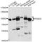 Pyridoxal Dependent Decarboxylase Domain Containing 1 antibody, A14856, ABclonal Technology, Western Blot image 