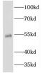 Keratin 81 antibody, FNab04658, FineTest, Western Blot image 