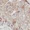 CDHE antibody, FNab02618, FineTest, Immunohistochemistry frozen image 