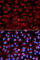 Histone Deacetylase 6 antibody, A1732, ABclonal Technology, Immunofluorescence image 