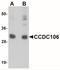 Coiled-Coil Domain Containing 106 antibody, NBP1-77381, Novus Biologicals, Western Blot image 