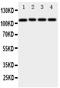 Disintegrin and metalloproteinase domain-containing protein 19 antibody, PA2070, Boster Biological Technology, Western Blot image 