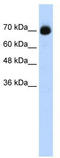 CXXC Finger Protein 1 antibody, TA343743, Origene, Western Blot image 