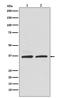 RAD51 Recombinase antibody, M00088-1, Boster Biological Technology, Western Blot image 