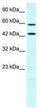 Long-chain-fatty-acid--CoA ligase 1 antibody, TA331164, Origene, Western Blot image 