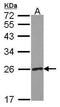 Ribulose-5-Phosphate-3-Epimerase antibody, GTX114724, GeneTex, Western Blot image 