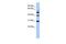 Tubulin Tyrosine Ligase antibody, GTX45596, GeneTex, Western Blot image 