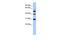 Tubulin--tyrosine ligase antibody, GTX45596, GeneTex, Western Blot image 