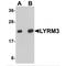 NADH:Ubiquinone Oxidoreductase Subunit B9 antibody, MBS150080, MyBioSource, Western Blot image 